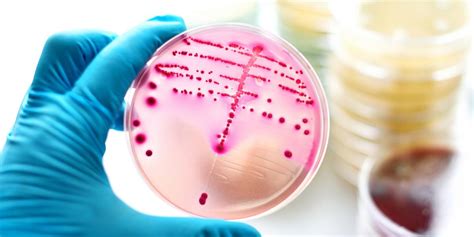 Paciorkowiec A Poród Jak Można Się Zarazić Jak Zdiagnozować Bakterie