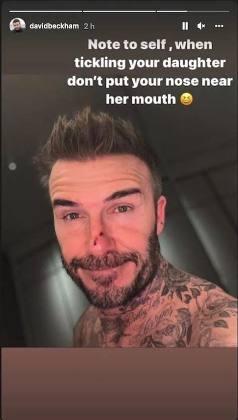 David Beckham Reveals Nasty Cut To His Nose After Daughter Harper Bit Him The Great Celebrity