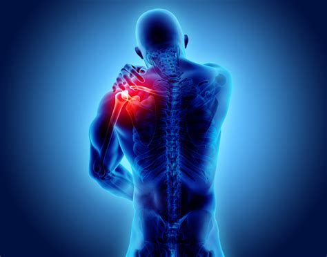 Shoulder Pain Causes Diagnosis And Treatment Southern Pain And