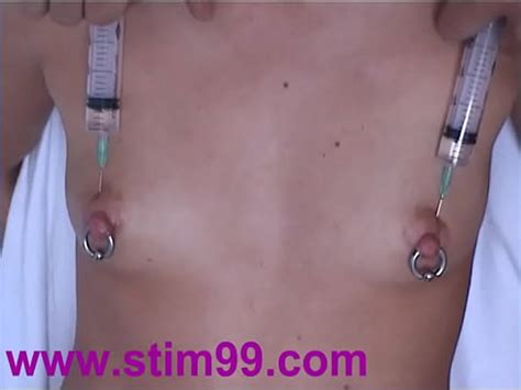 Inyección de solución salina en los pezones de los senos Bombeo de