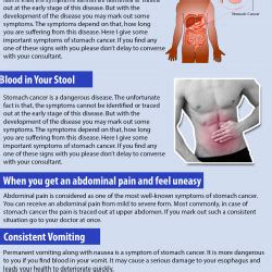 Other similar signs and symptoms of stomach cancer and stomach ulcers include weight loss and anemia. Warning Signs of Stomach Cancer | Visual.ly