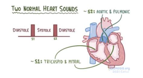 pd cards heart sounds and murmurs flashcards quizlet