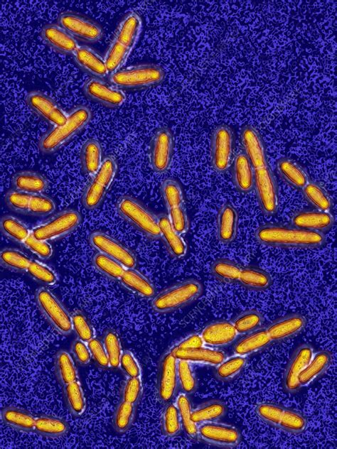 Listeria Monocytogenes Bacteria Lm Stock Image C0282780 Science