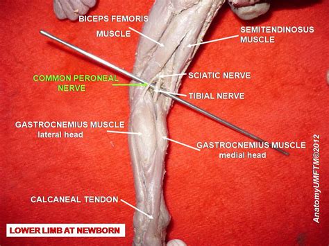 Regenerative Treatment For Common Peroneal Nerve Injuries