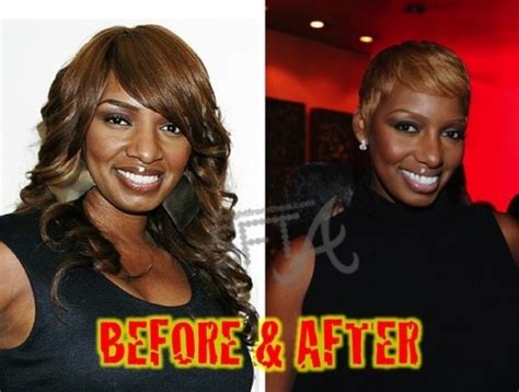 NeNe Leakes Plastic Surgery Before And After Nose Jobs And Breast Implants Star Plastic Surgery