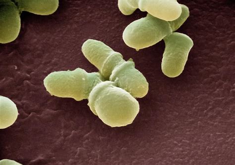 Malassezia Skin Fungus Photograph By Ami Imagesscience Photo Library