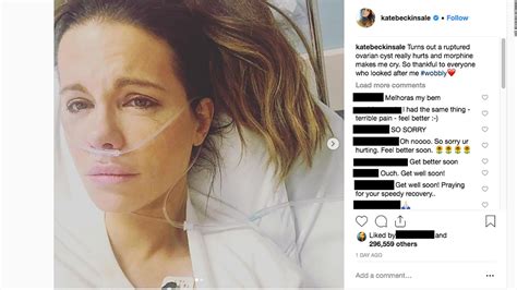 Kate Beckinsale Hospitalized With Ruptured Ovarian Cyst Cnn