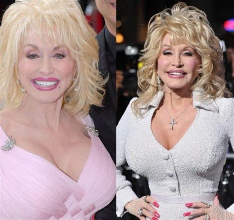 Dolly Parton Breast Implants Dolly Parton Plastic Surgery Pinterest