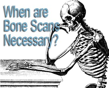 Bone Scans - When Are They Necessary? | CDI Miami