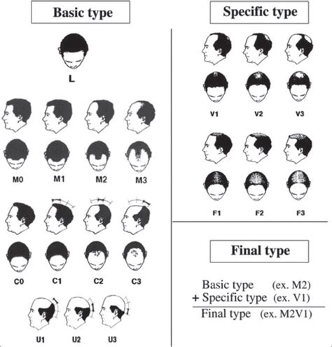 Female Pattern Hair Loss Indian Journal Of Dermatology Venereology