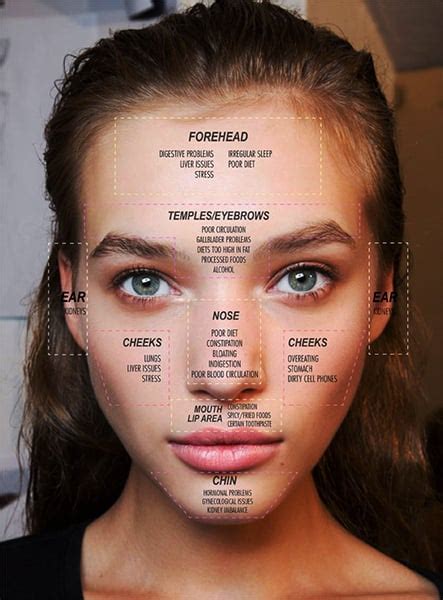 Types Of Acne And What It Reveals About Your Overall Well Being