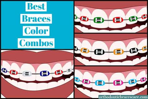 Best Braces Color Combinations For Seasons And Holidays Orthodontic