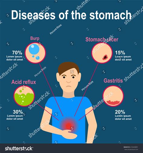 Stomach Pain Infografics Stock Vector (Royalty Free) 410440891