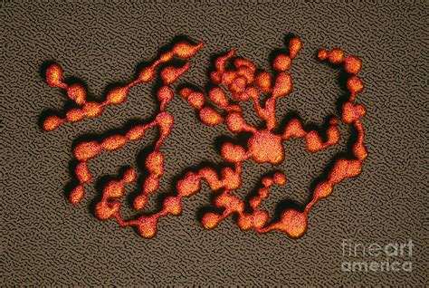 Mycoplasma Pneumoniae Sem Photograph By Chris Bjornberg Pixels