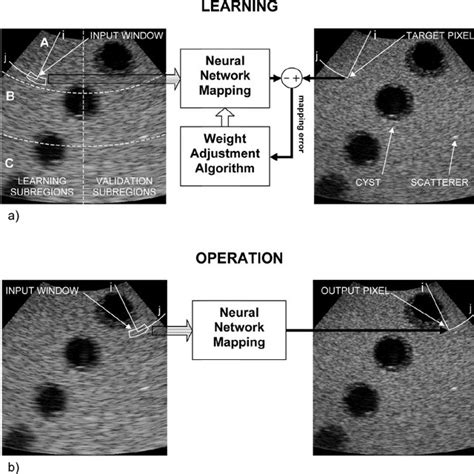 Pdf Spatial Resolution Enhancement Of Ultrasound Images Using Neural