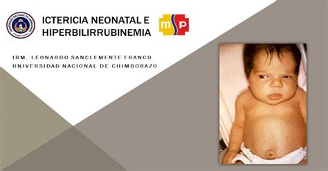 Ictericia Neonatal E Hiperbilirrubinemia Pptx Powerpoint