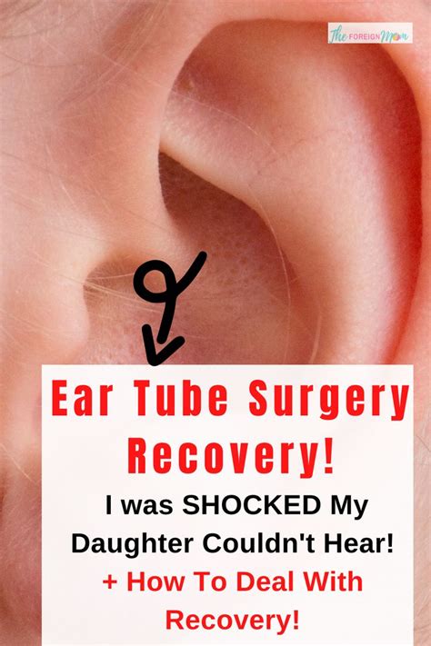 Ear Tube Surgery Recovery In 2020 Ear Tubes Surgery Recovery Surgery