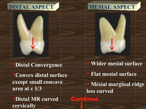 4 Maxillary Molars