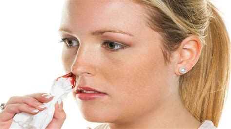 Nosebleeds Causes Symptoms And Treatment