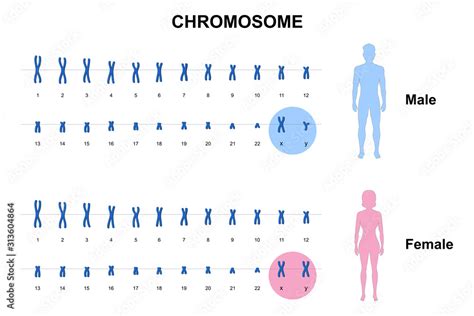 Autosome And Sex Chromosome Normal Human Karyotype Men And Women The Sexiz Pix