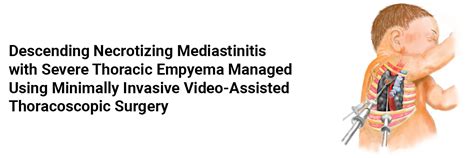 Descending Necrotizing Mediastinitis With Severe Thoracic Empyema