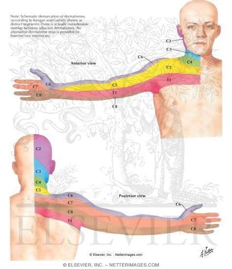 Dermatomes Of Upper Limb With Images Physical Therapy Assistant