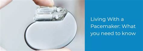 Living With A Pacemaker What You Need To Know Bmb