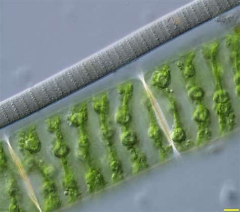 Cyanobacteria Free Living Cyanobacterium Above Lies Next To Its