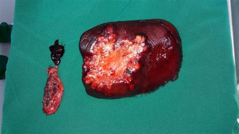 Simple Science: How to Make a Volcano with Kids