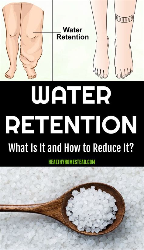 Water Retention What Is It And How To Reduce It Water Retention