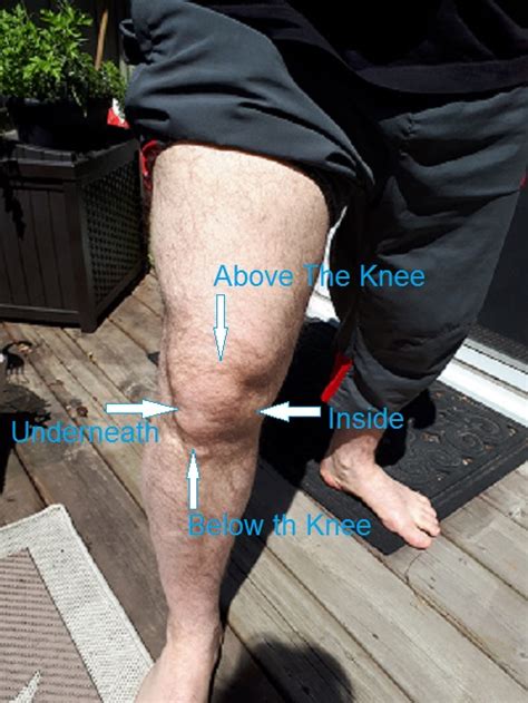 Knee Soreness Assess Hip And Foot Mike Grafstein