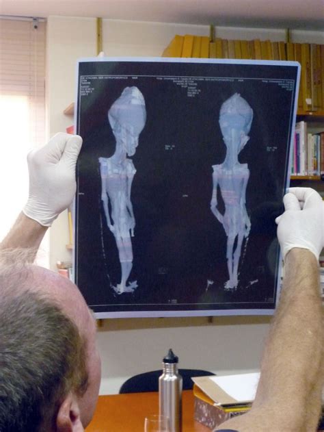 Kein Außerirdischer: Forscher enträtseln Mumie Ata - DER SPIEGEL