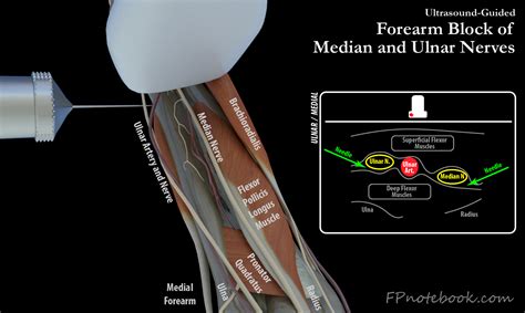 Ulnar Nerve Block