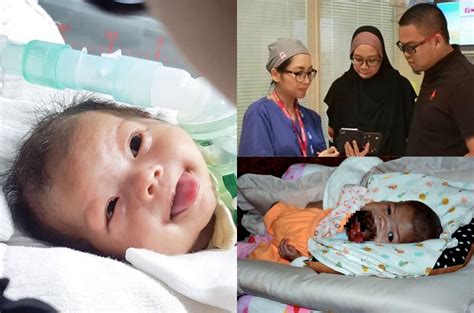 32,064 likes · 108 talking about this. Baby Ainul Mardhiah's Tumour Succesfully Removed After 5 ...