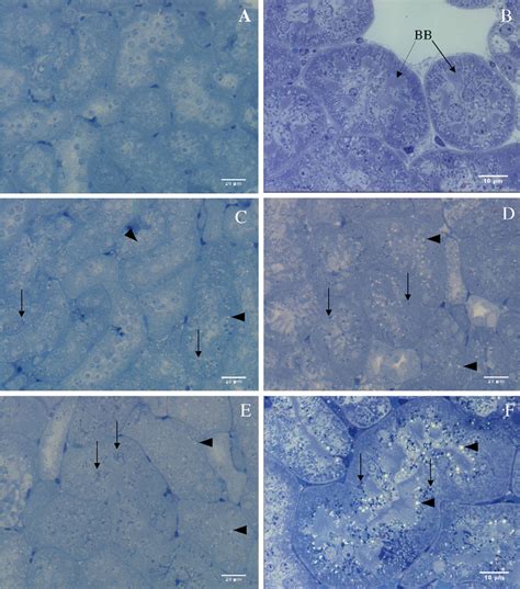 Light Photomicrographs Of Renal Tissue In Chronic Cd Administered Mice