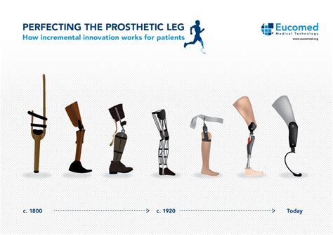 How Innovation Has Perfected The Prosthetic Leg For The Last 200 Years
