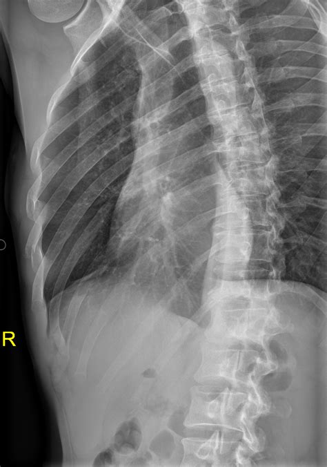 Neck X Ray Anatomy