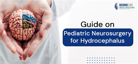 Guide On Pediatric Neurosurgery For Hydrocephalus