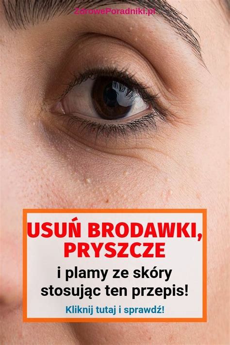Pieprzyki U Dzieci Zdjęcia Polska Zdjecia