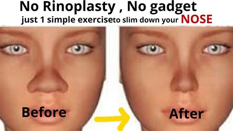 Slim Down Your Nose With 1 Simple Exercise Reshapenose Very Effective