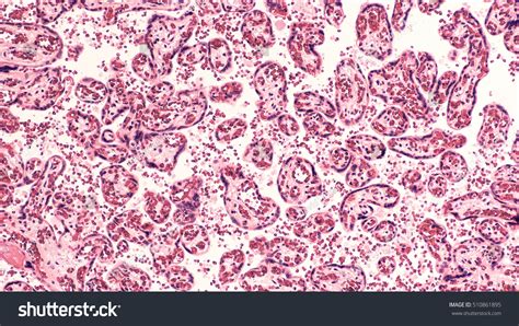 Human Placental Histology Microscopic Image Cross Stock Photo 510861895
