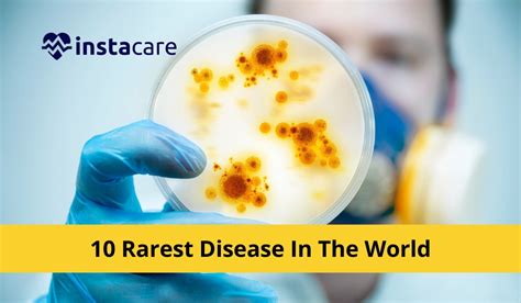10 Rarest Disease In The World