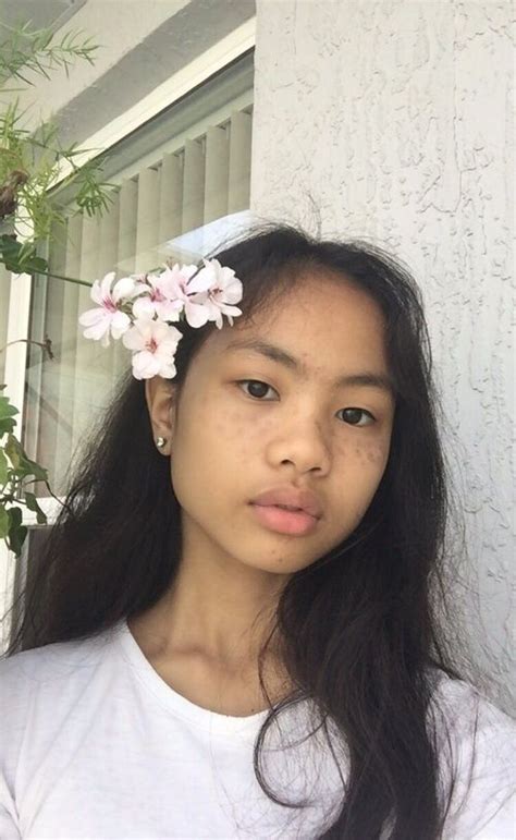 Flat Filipino Nose