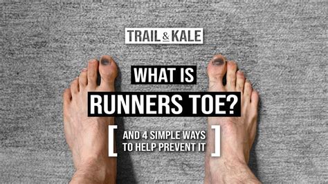 What Is Runners Toe How To Prevent Bruised Toenails
