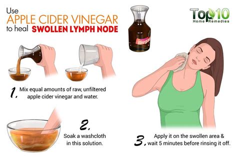 Home Remedies For Swollen Lymph Nodes Apple Cider Vinegar Remedies
