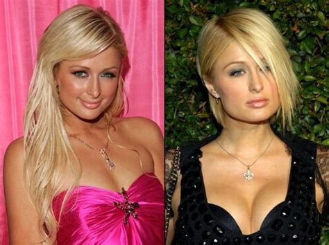Toddler room before & after. Paris Hilton Plastic Surgery Before and After
