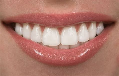 Quick Dentures