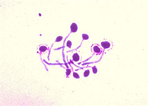 Public Domain Picture Candida Albicans Showing Germ Tube Production
