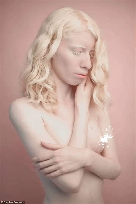 Albino Model Challenges Beauty Standards By Embracing Her Pale Skin And