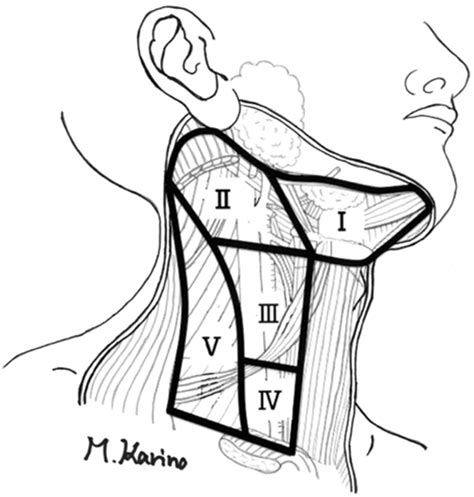 A polycyclic extension can be seen at the lateral end. Illustration of each level of the cervical lymph node ...